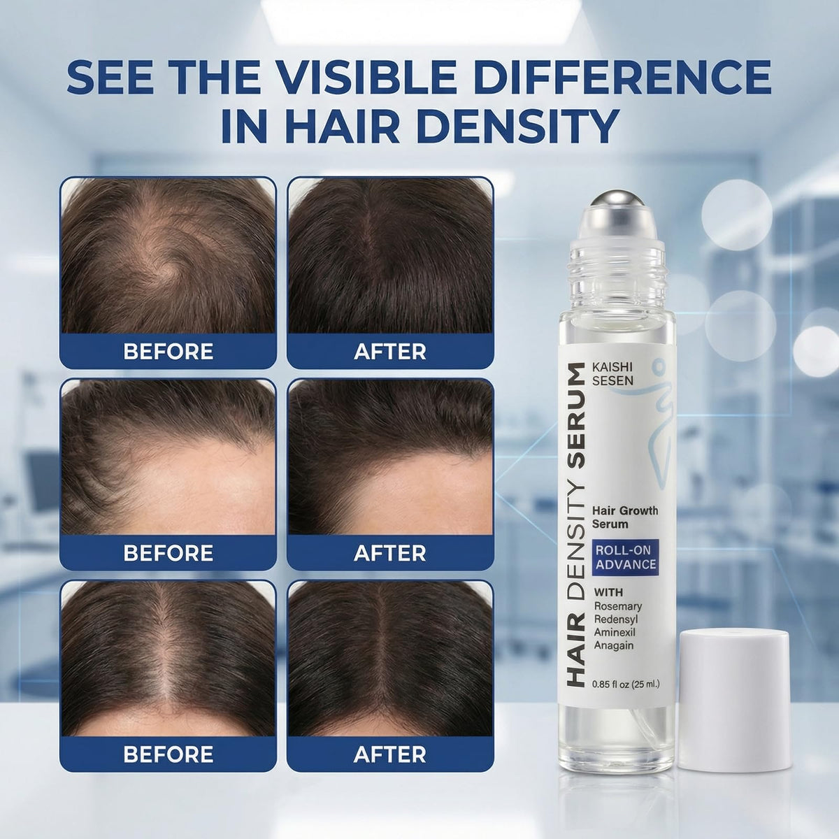 KAISHISESEN Hair Growth Serum Roll On closeup of precision application on scalp