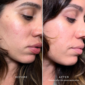 Application on cheek of Karuna All Day Firming Serum illustrating lightweight hydration