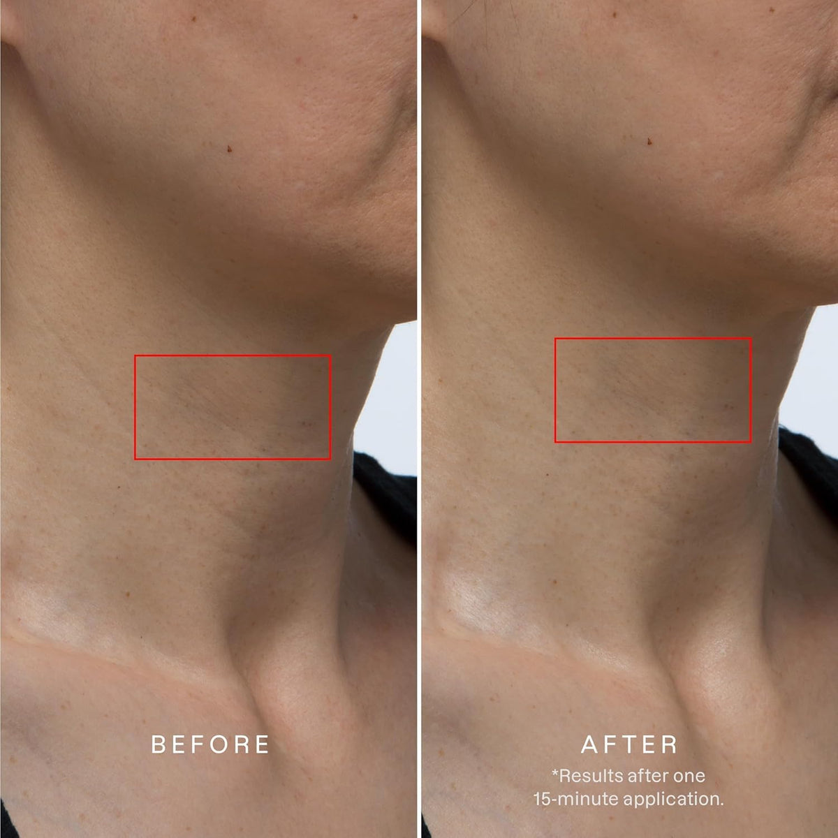 Karuna neck-chest mask application close-up delivering cooling moisture.