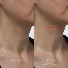 Karuna neck-chest mask application close-up delivering cooling moisture.