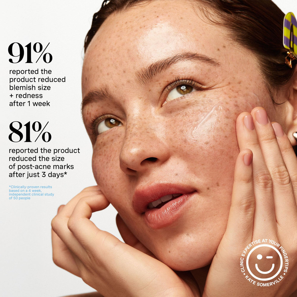 Hand applying EradiKate to targeted areas for potential breakouts reduction