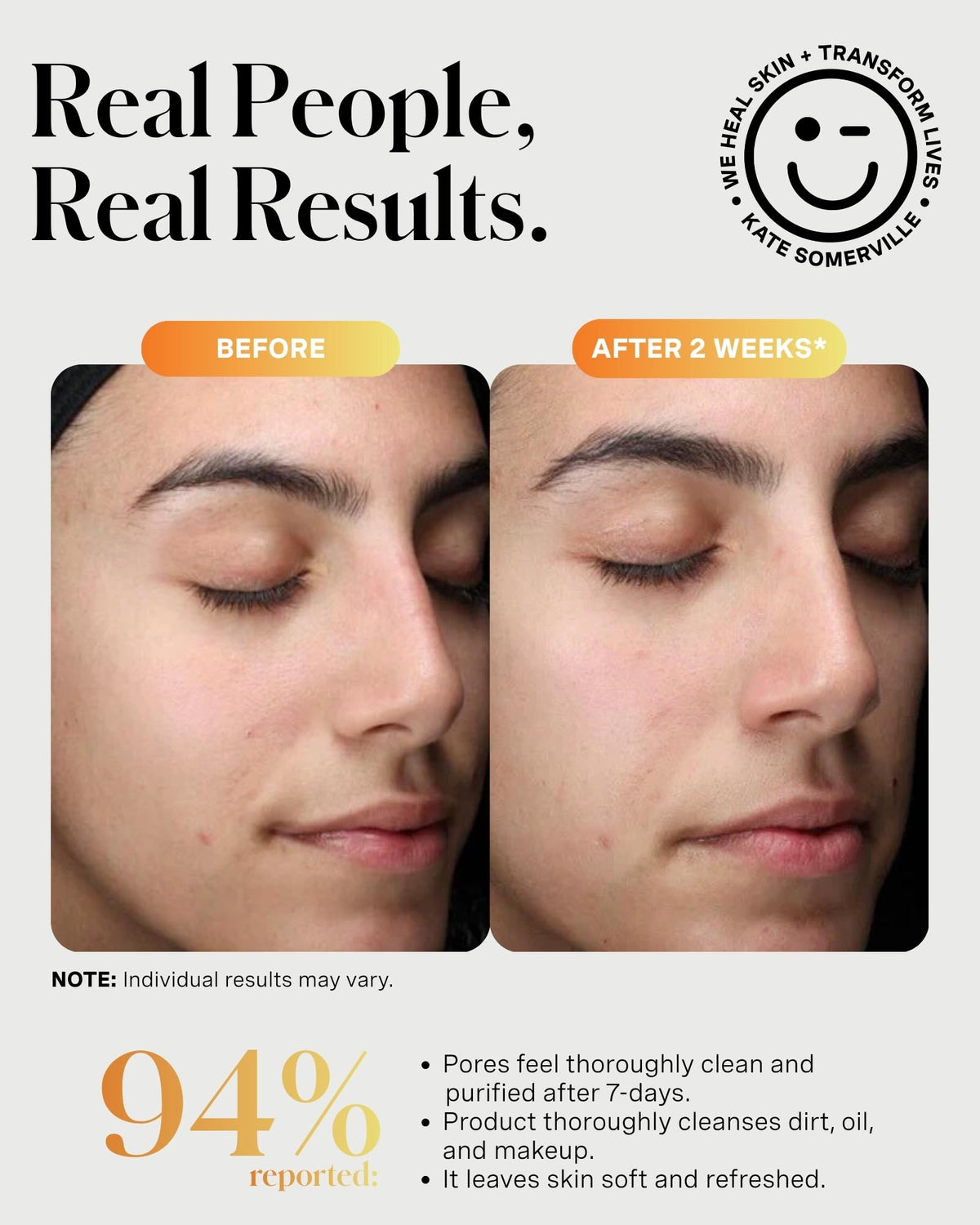 Kate Somerville ExfoliKate Cleanser fruit enzymes purify pores for clarity.