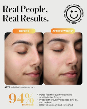 Kate Somerville ExfoliKate Cleanser fruit enzymes purify pores for clarity.