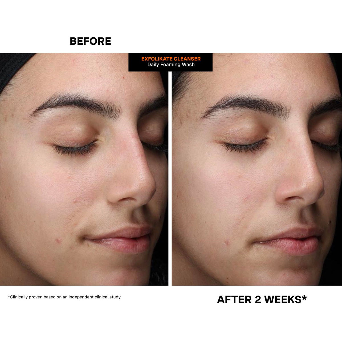 Kate Somerville ExfoliKate Cleanser leaves skin softer and refined.