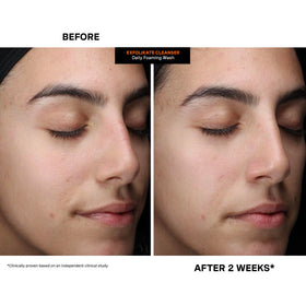 Kate Somerville ExfoliKate Cleanser leaves skin softer and refined.