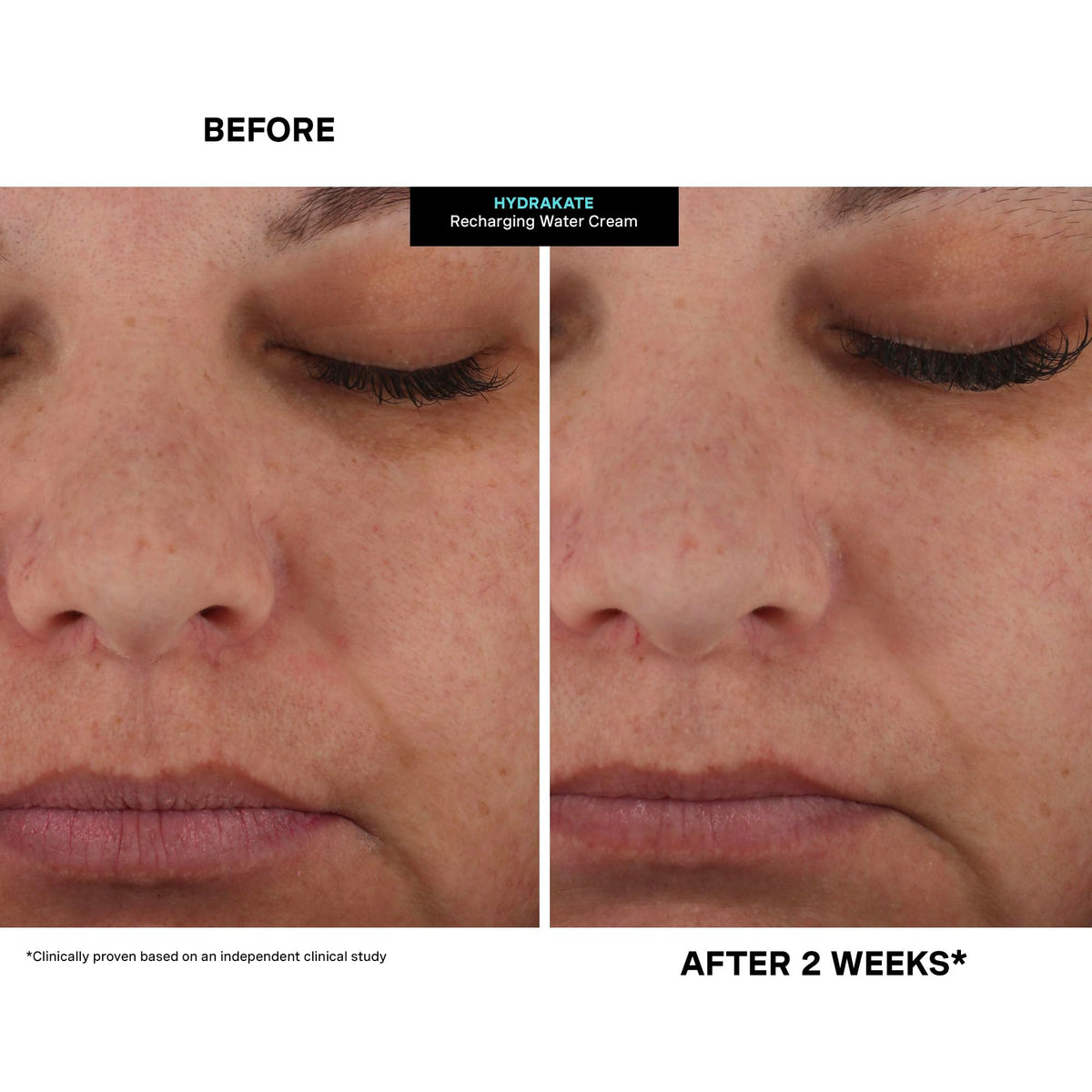 Clinic to home heritage highlights dermatologist-inspired results at home.