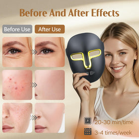 Kelyoo red light mask side view highlighting ergonomic comfort for home use.