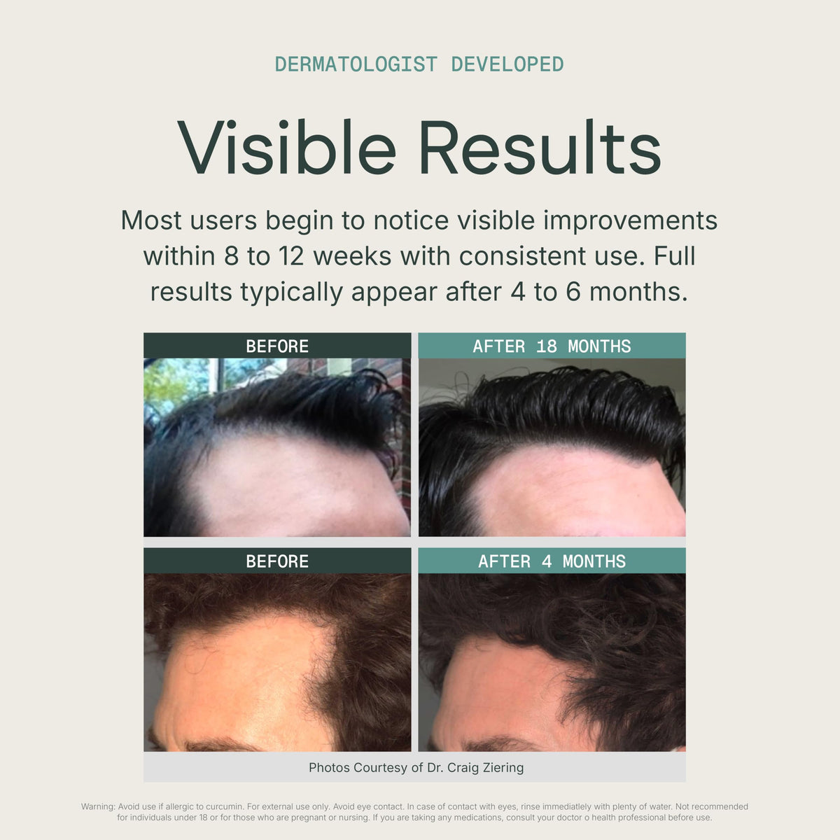 KeraFactor daily-use application on clean scalp; no rinse needed.