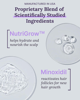 Keranique Minoxidil Foam applied to scalp for targeted treatment