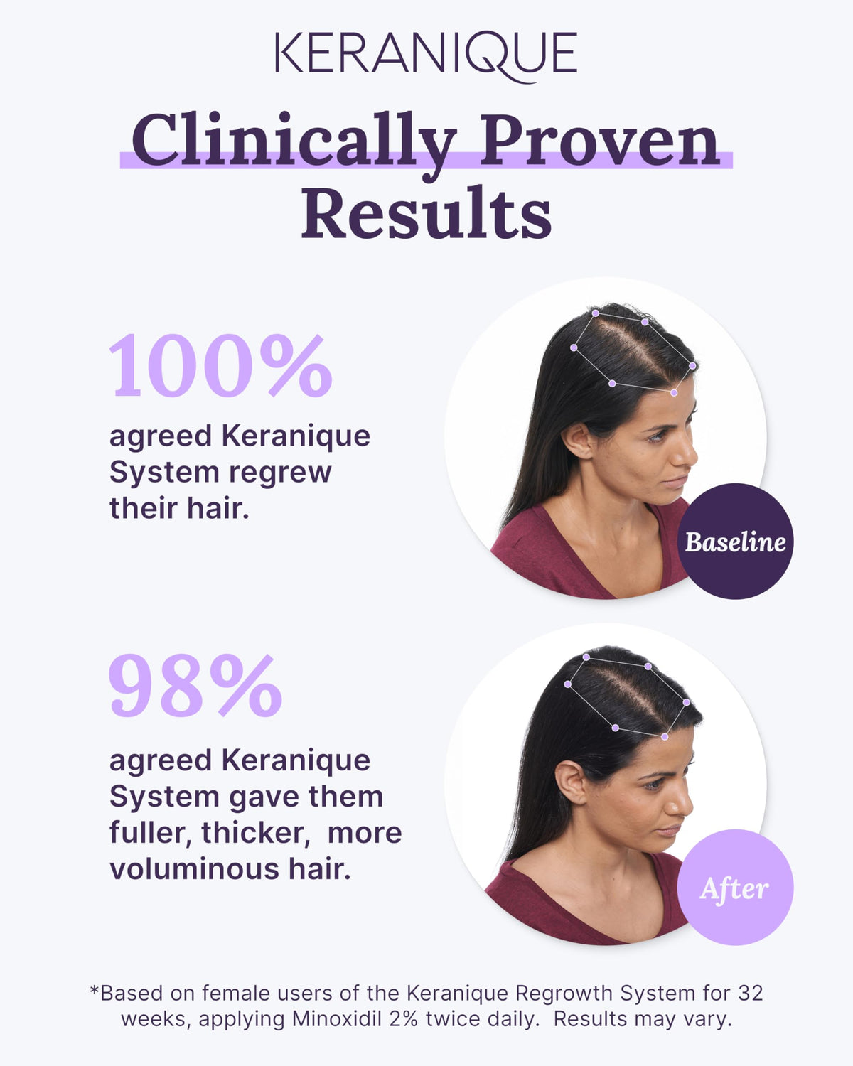 Keranique NutriGrow blend hydrates and nourishes the scalp