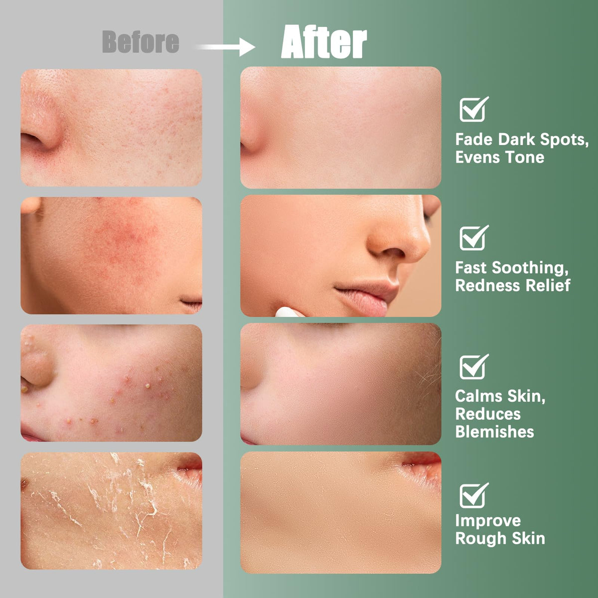 Kestper Madecassoside & Caffeine Toner Pads depuff closeup for refreshed mornings