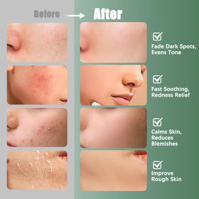 Kestper Madecassoside & Caffeine Toner Pads depuff closeup for refreshed mornings