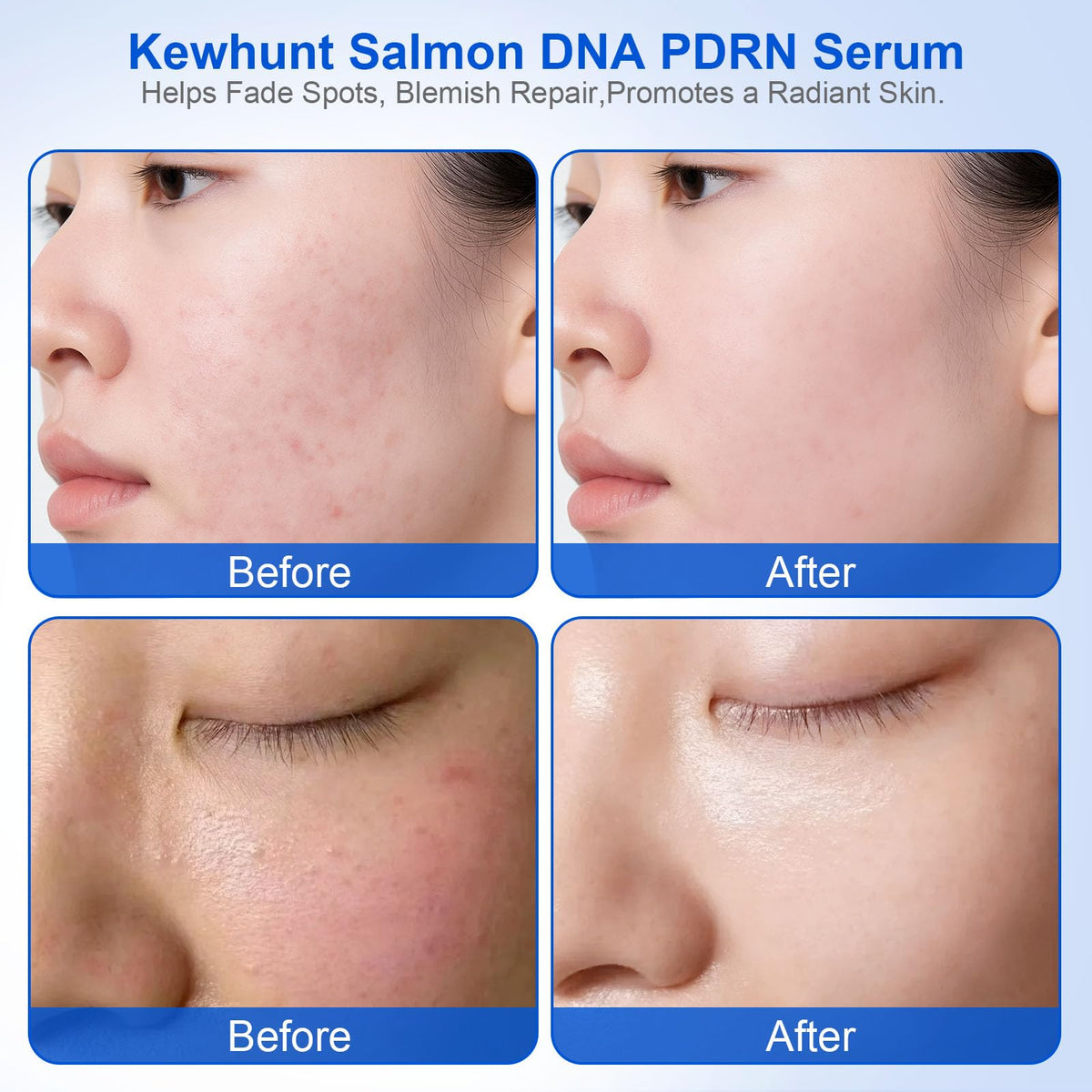 Kewhunt niacinamide and glutathione tone, targeting even skin and brightness.