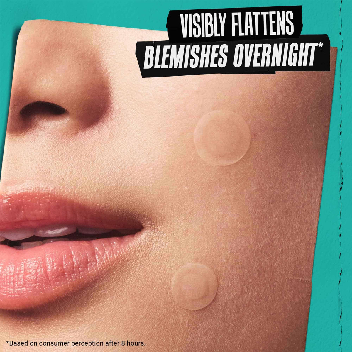 Patch worn overnight feels comfortable and unobtrusive on facial skin.