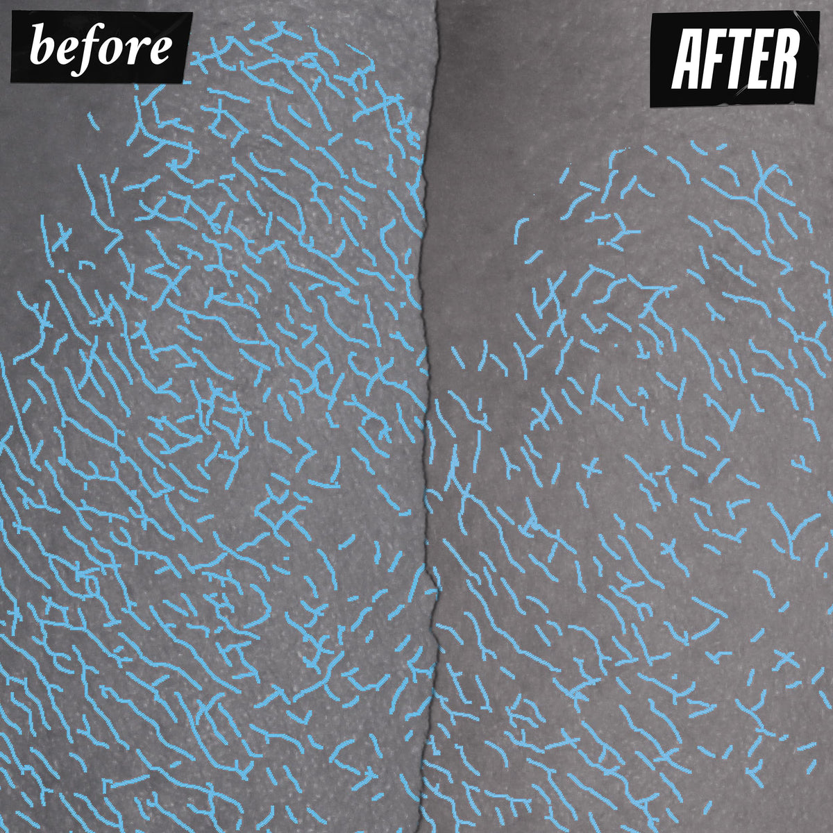 Kiehl's triple acid peel texture close-up highlighting gentle exfoliation.