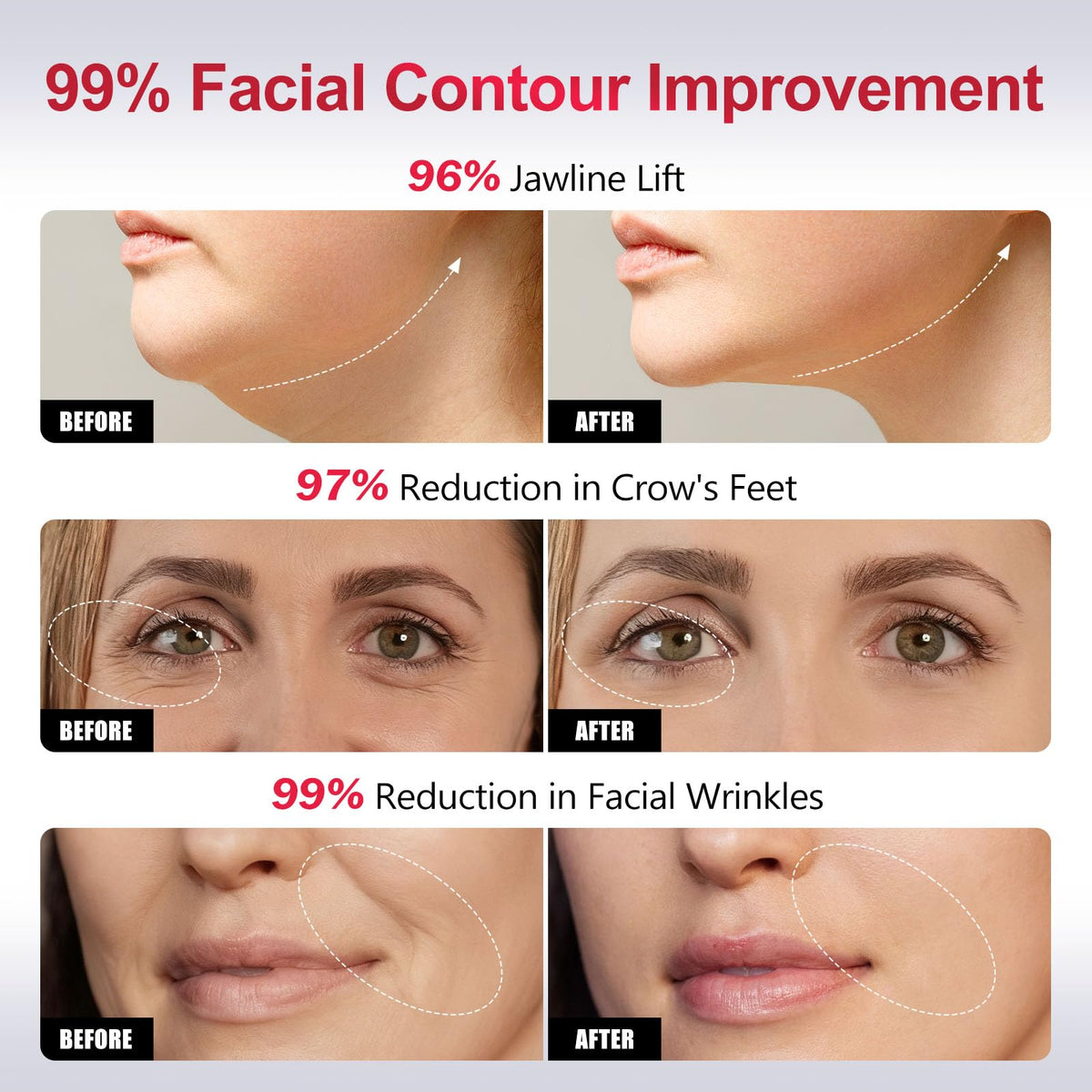KIHIF EP-300 daily rejuvenation for elasticity and a refreshed look