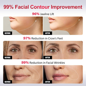KIHIF EP-300 daily rejuvenation for elasticity and a refreshed look