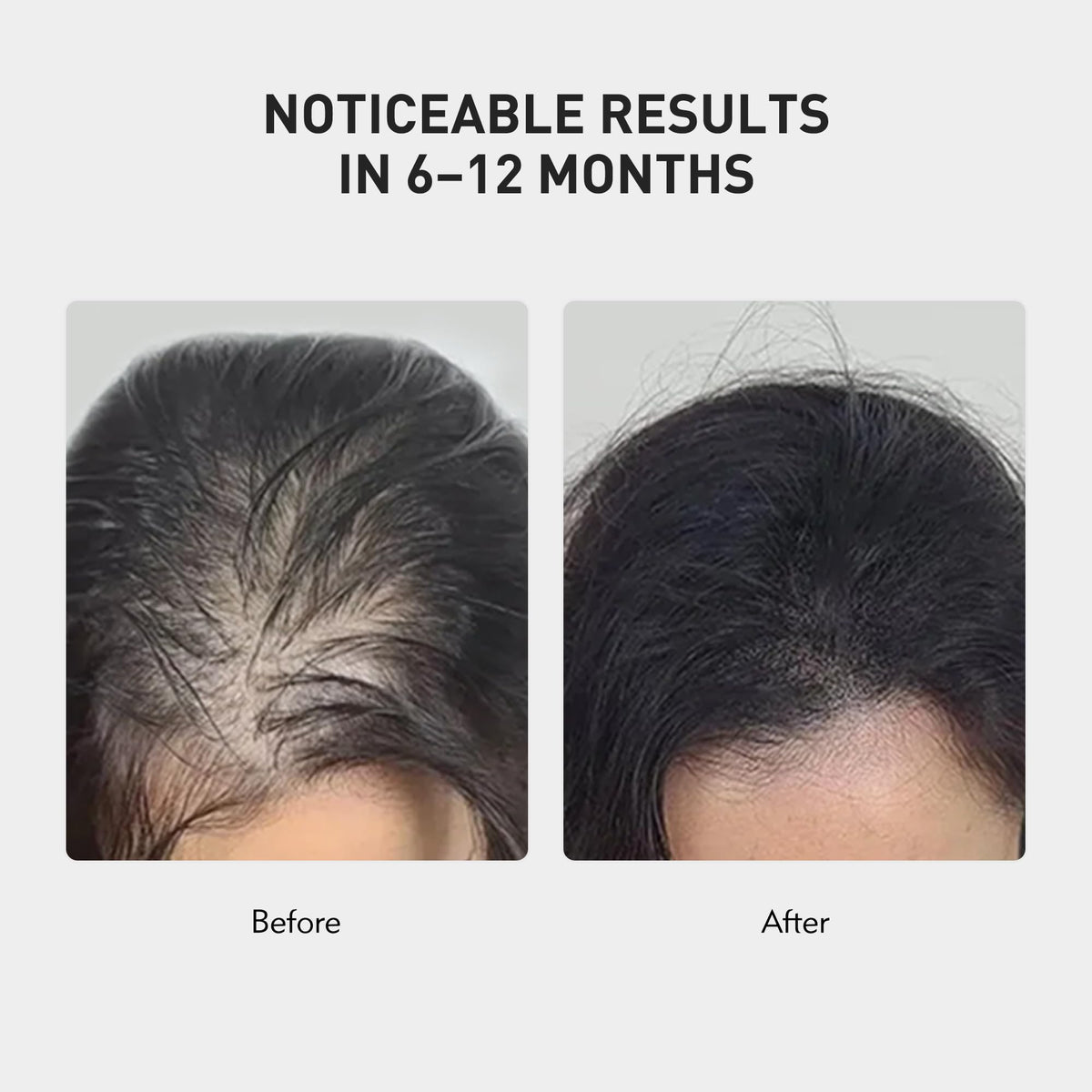 KINTOR Hair Regrowth Spray bottle cap close-up highlights trusted formula