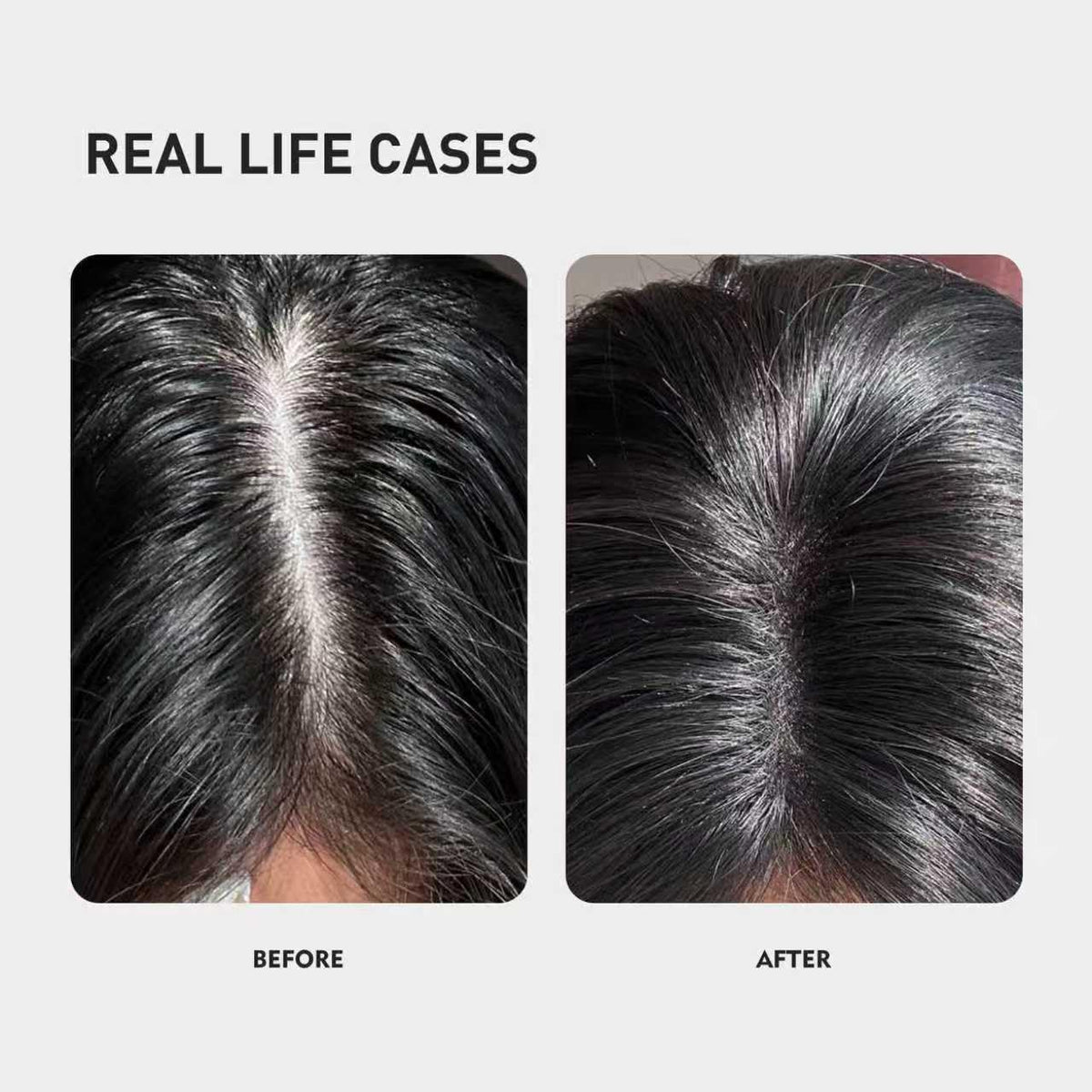 KINTOR KX-826 Pro scalp application closeup.
