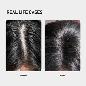 KINTOR KX-826 Pro scalp application closeup.