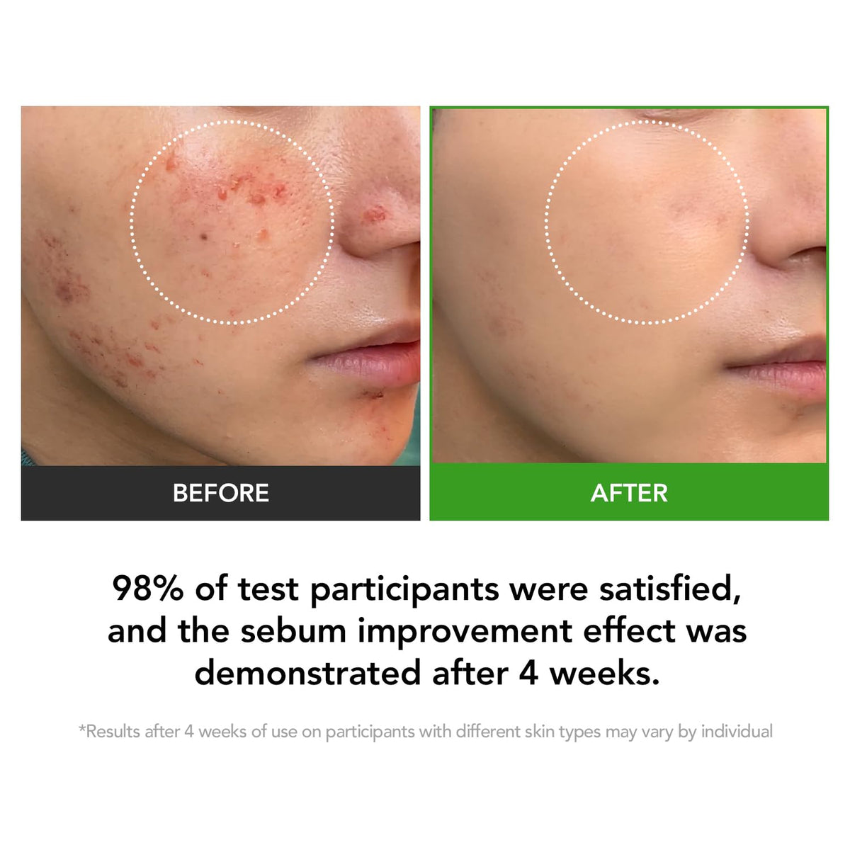 KIOSKIN Cica Exosome concept emphasizing deeper delivery into skin.