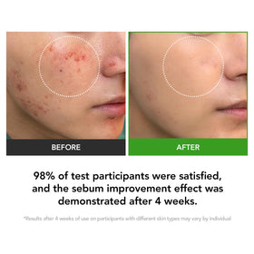 KIOSKIN Cica Exosome concept emphasizing deeper delivery into skin.