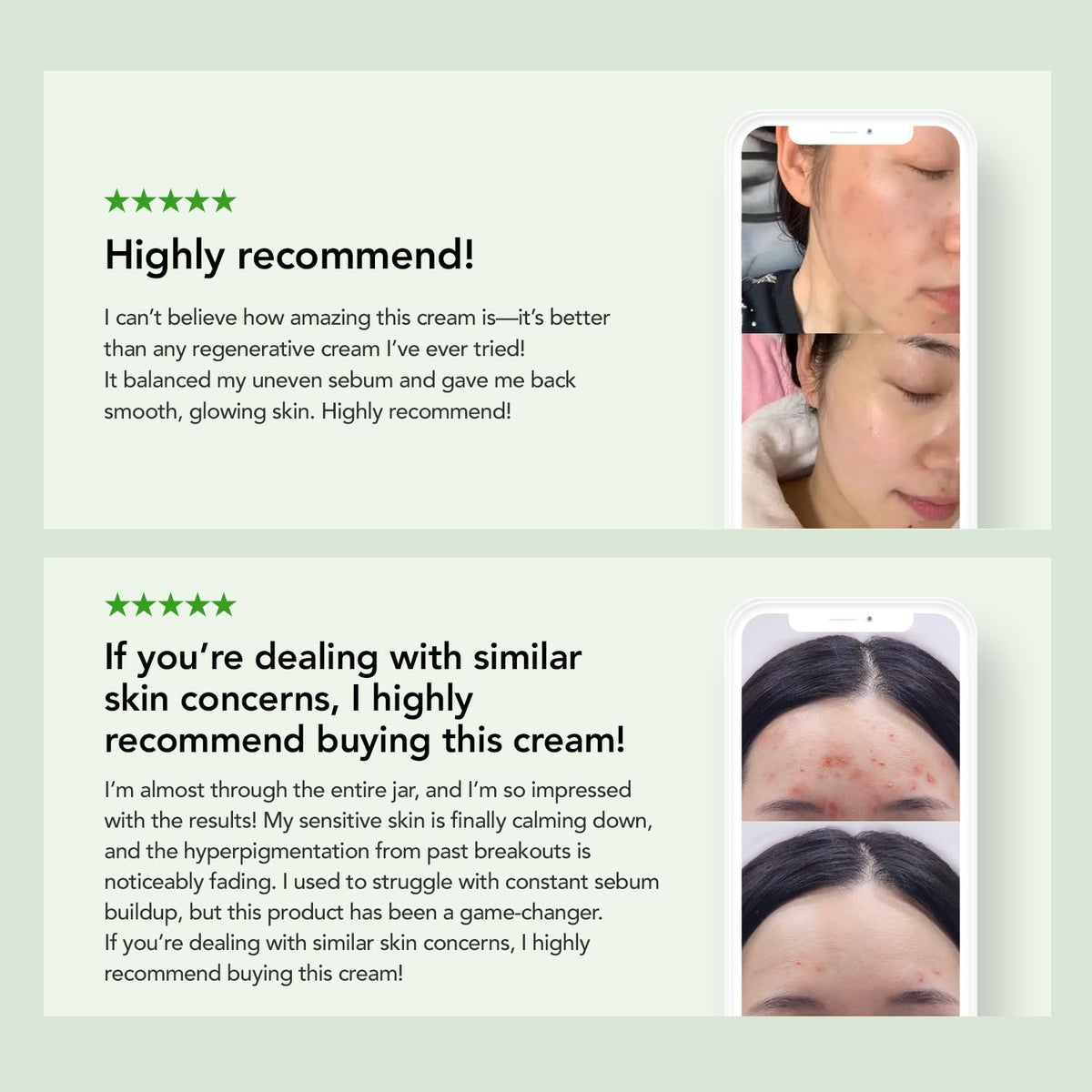 KIOSKIN barrier repair illustration for sensitive skin.