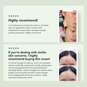 KIOSKIN barrier repair illustration for sensitive skin.