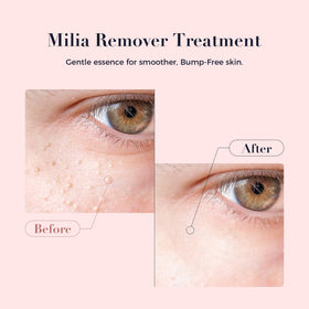 Kisinly Milia Remover fluid texture close-up for quick absorption