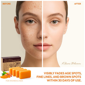 KlearBloom Kojic Turmeric Soap Bar lathering, a gentle daily cleanser for radiant skin