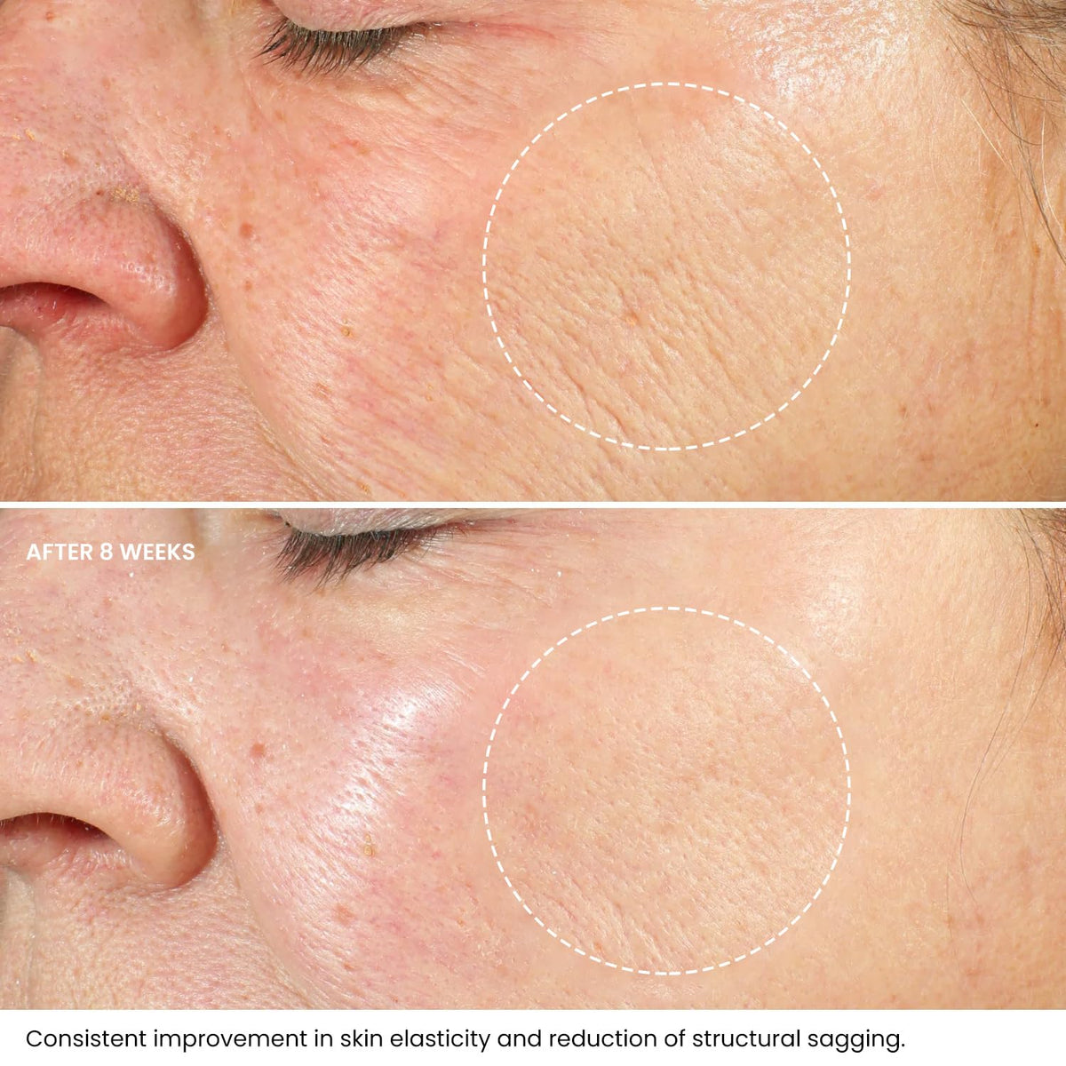 Kleem Organics Hyaluronic Acid Panthenol ingredients chart suggests hydrating care.