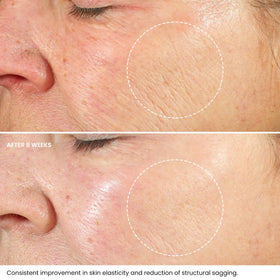 Kleem Organics Hyaluronic Acid Panthenol ingredients chart suggests hydrating care.