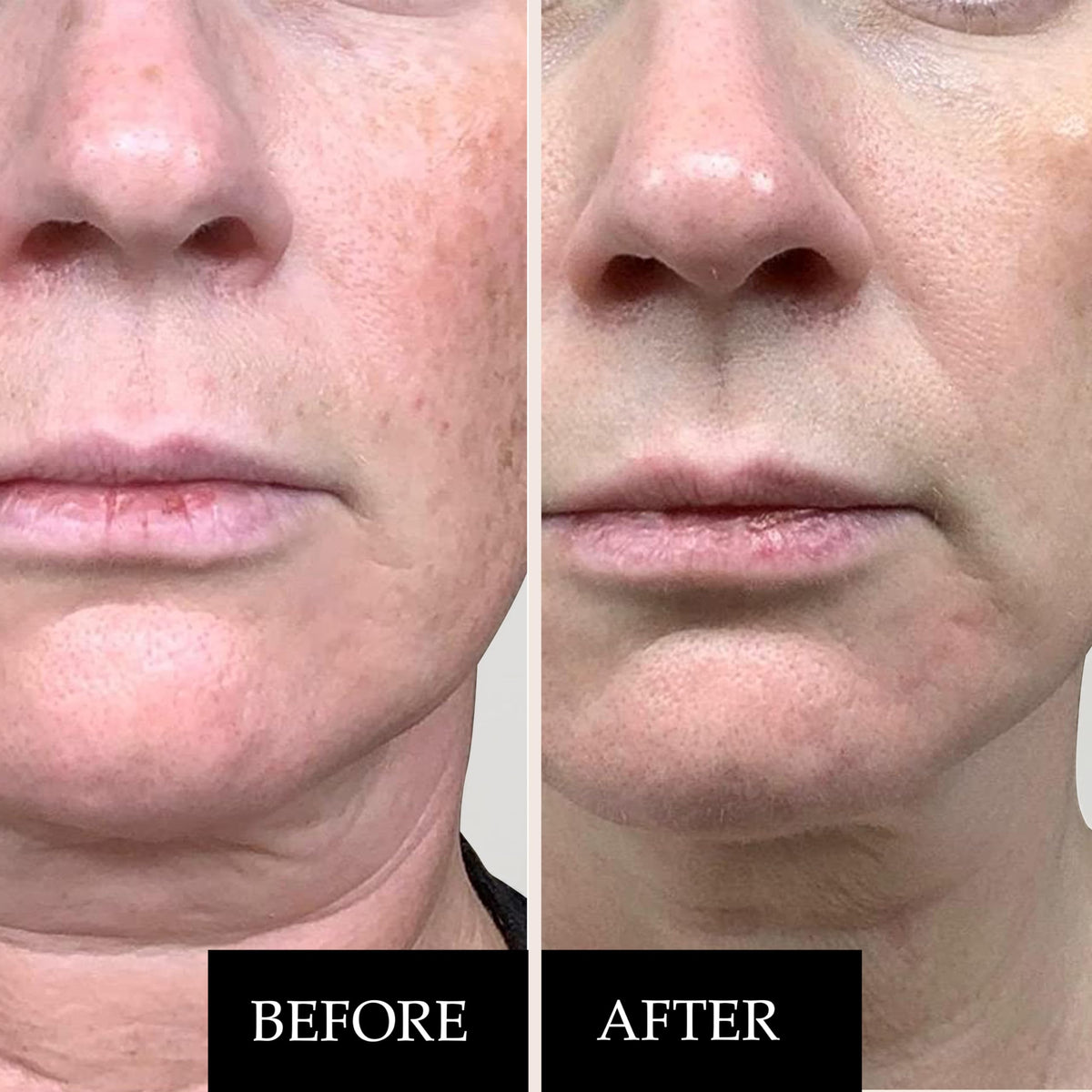 Kleem Organics hyaluronic acid serum provides deep, soft hydration