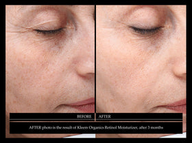 Kleem Organics Night Cream being applied on hand for moisturizer test.
