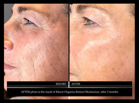 Kleem Organics Night Cream swirl on skin hints at velvety finish.