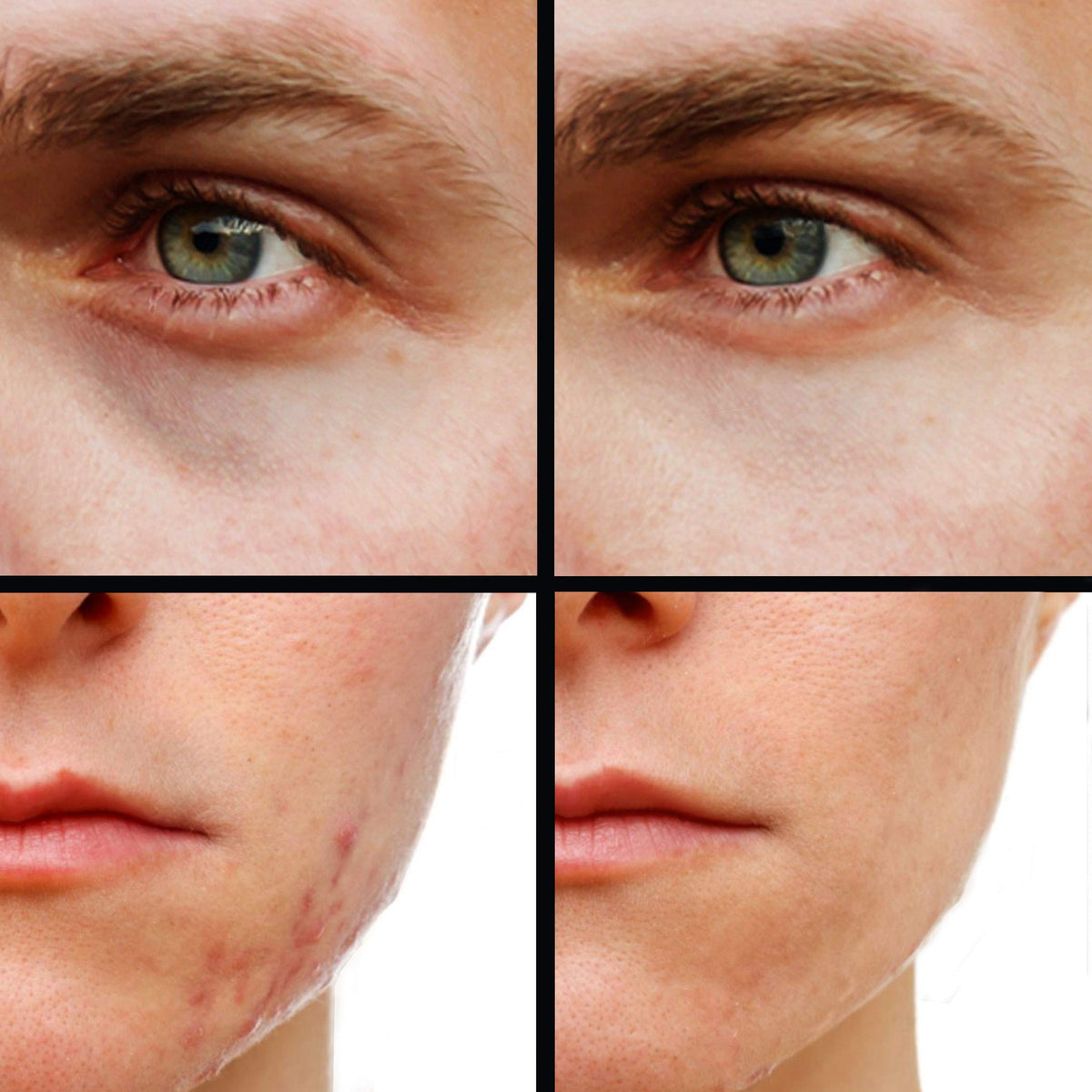 KODE Mens Concealer Lightest six-shade range on packaging highlights options