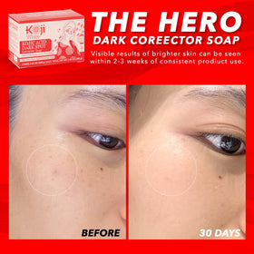 Koji White dark spot corrector bar pack shows two bars for even tone.