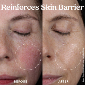 Kopari Nourishing Hydro-Lipid Serum ingredients highlight ceramides, hyaluronic acid, and squalane.