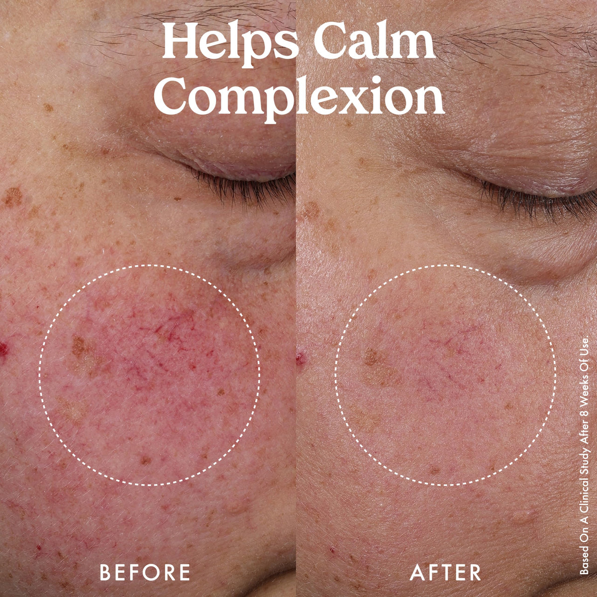 Kopari Nourishing Hydro-Lipid Serum featured in a night-time skincare routine.
