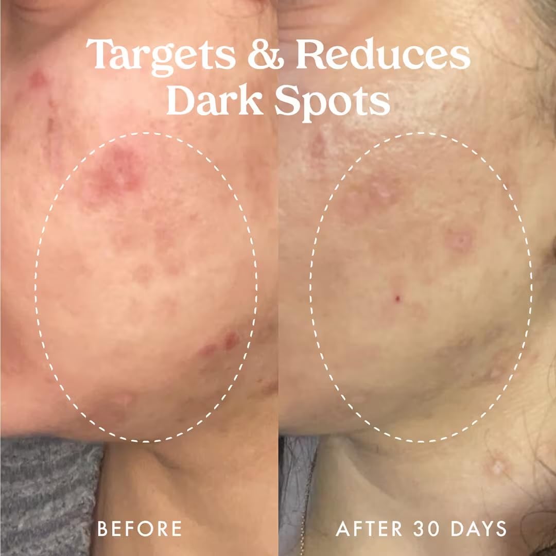 Kopari Star Bright serum texture close-up, smooth skin feel and non-greasy finish.
