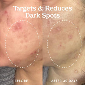 Kopari Star Bright serum texture close-up, smooth skin feel and non-greasy finish.
