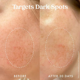 Antioxidant-rich formula helps protect against environmental stressors.