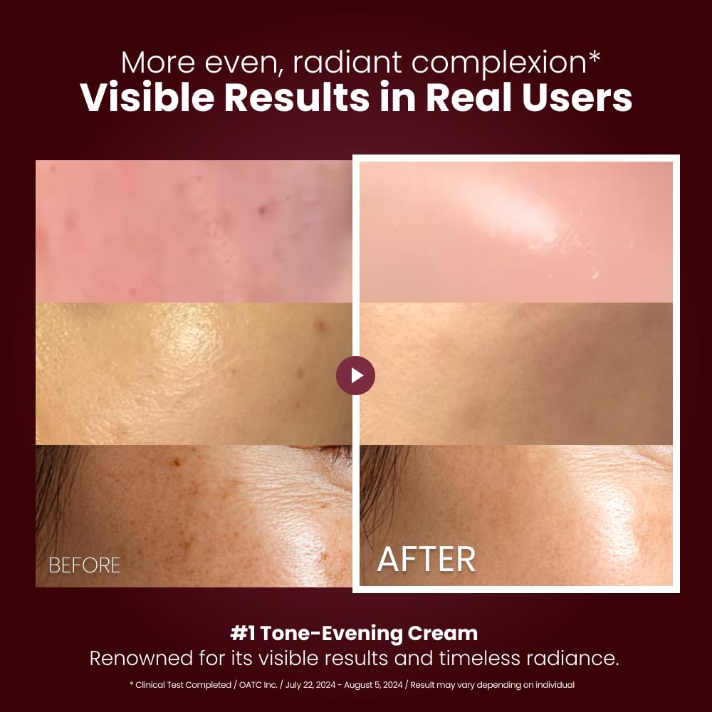 Kopher Curepair Mela Cream barrier-boost scene suggests smoother, healthier skin.