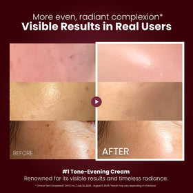 Kopher Curepair Mela Cream barrier-boost scene suggests smoother, healthier skin.