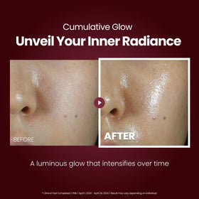 Kopher Curepair Melder SOS Cream application close-up with smooth texture.