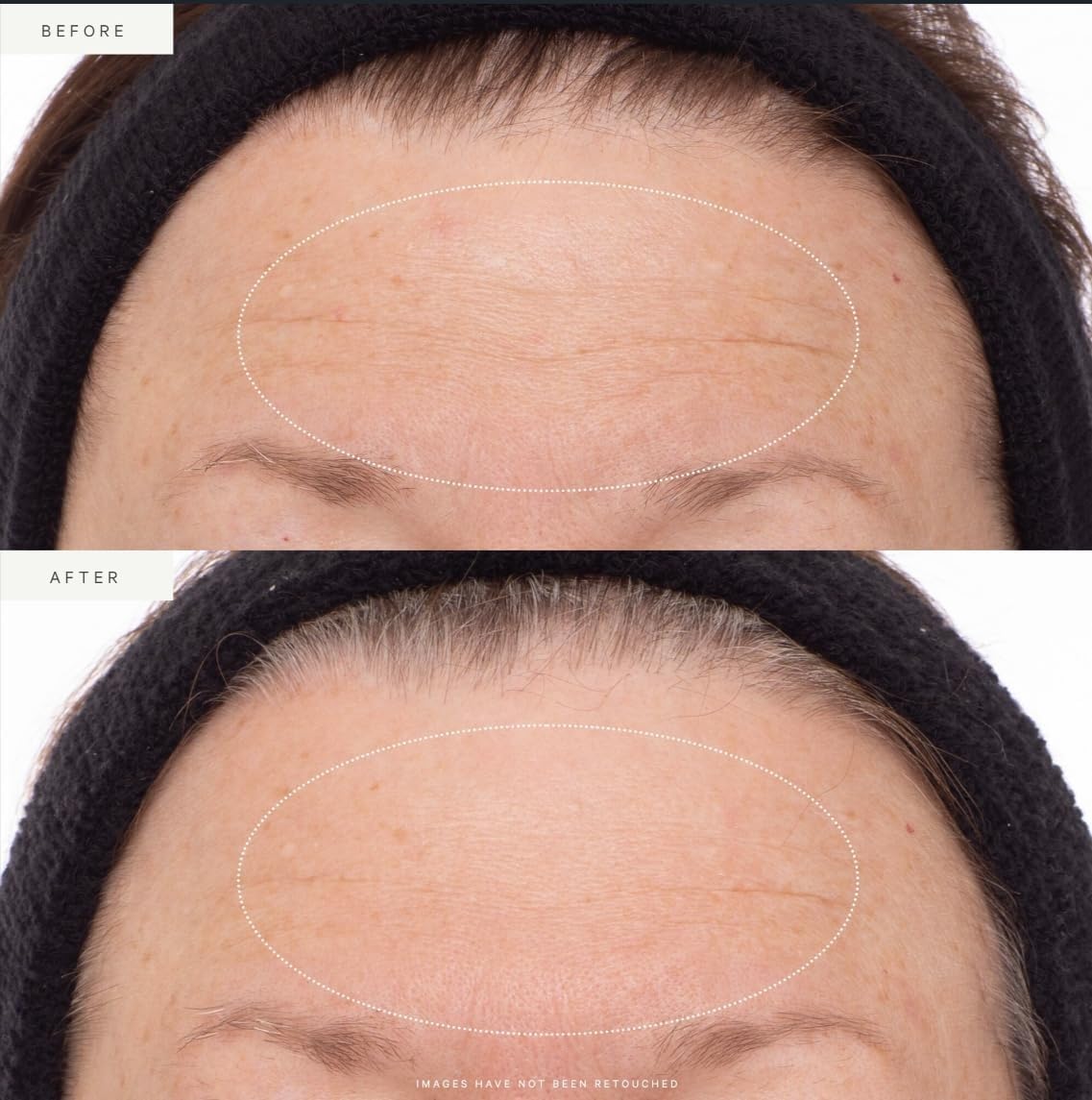 Applying serum on clean skin to target fine lines and firmness.