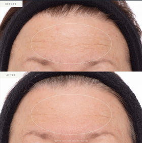 Applying serum on clean skin to target fine lines and firmness.
