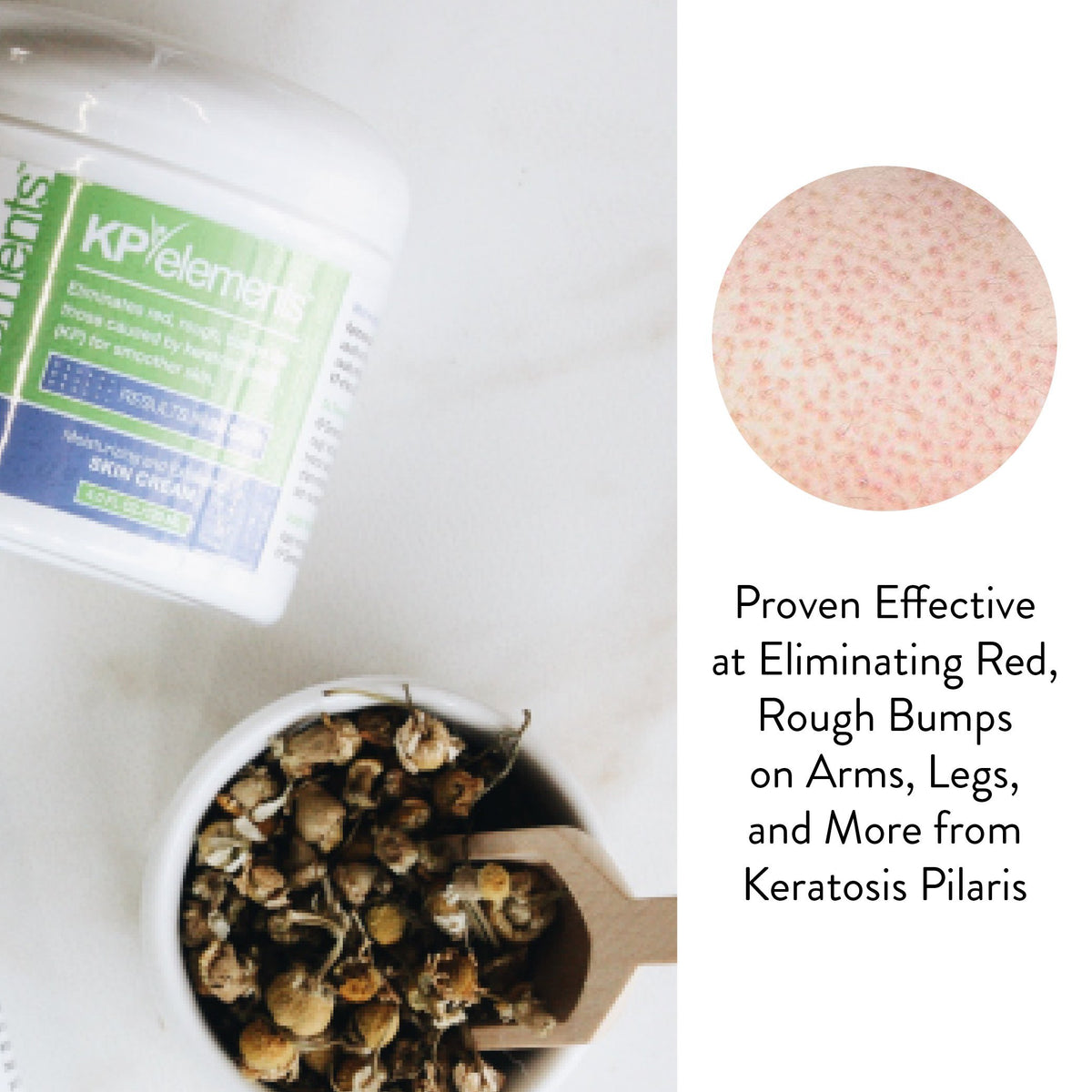 KP Elements natural botanicals and vitamins blend on label.