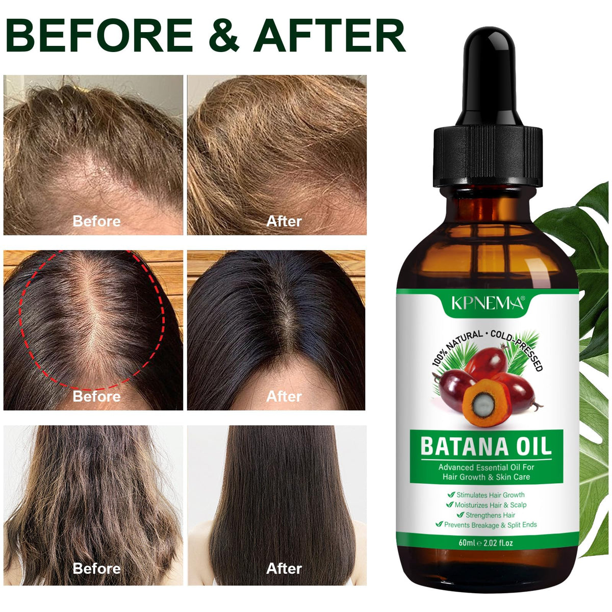 KPNEMA Batana oil antioxidants, helping protect skin from free radicals