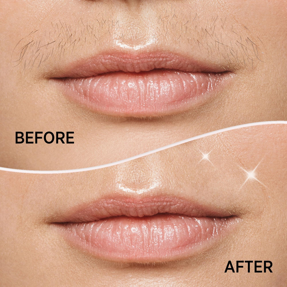 KRADAA Flawless Gen 2 replacement heads on the face for gentle upkeep.